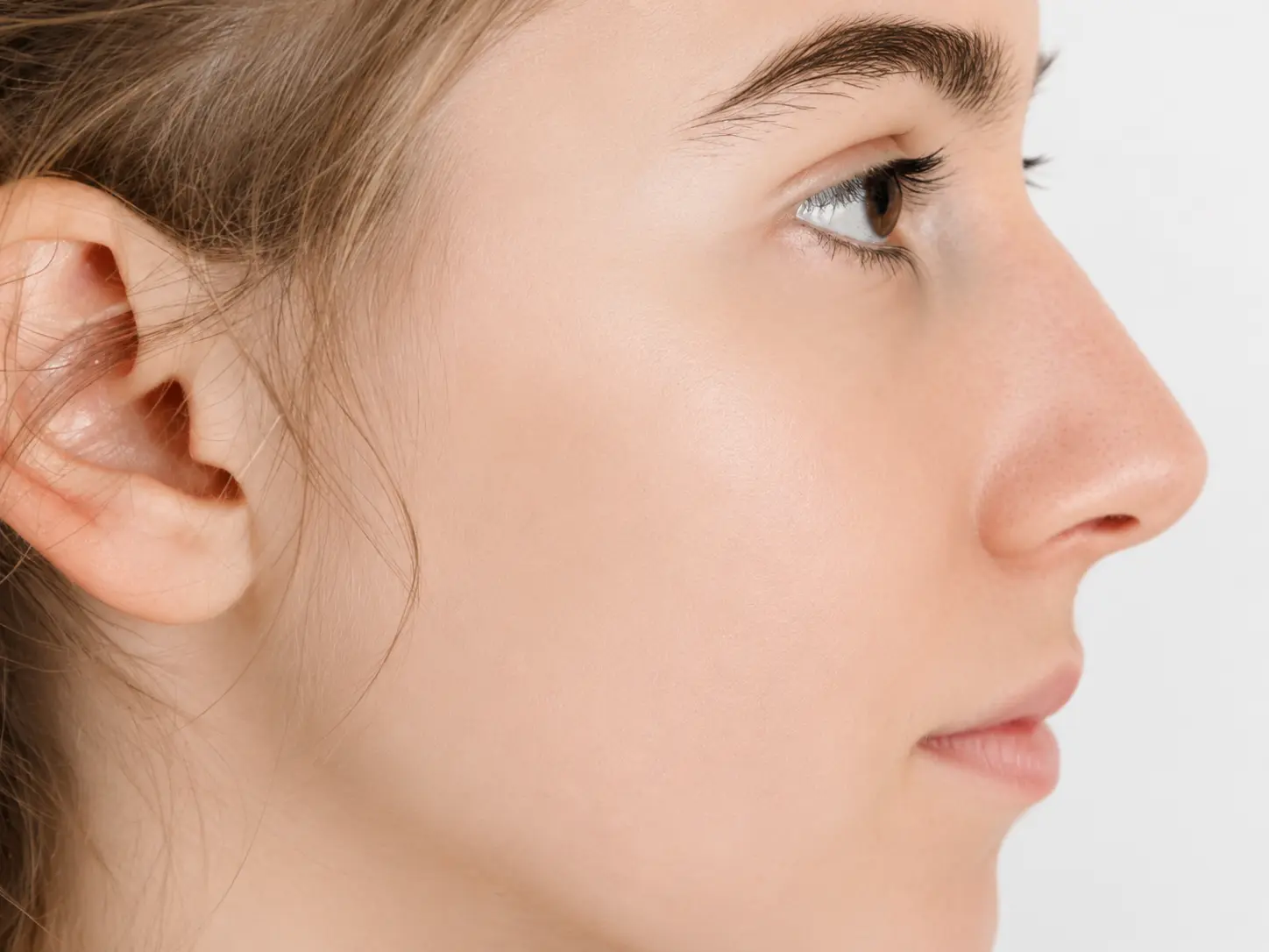 Acne treatment after result